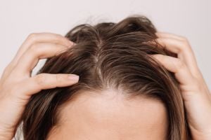 Vet haar? 8 tips om het natuurlijk aan te pakken