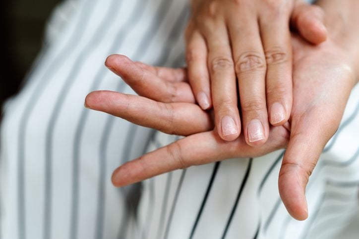Wat doe je tegen gespleten en broze nagels? 8 tips