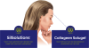 Collageen Solugel® sachets