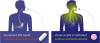 B12 5000 mcg Methylcobalamine