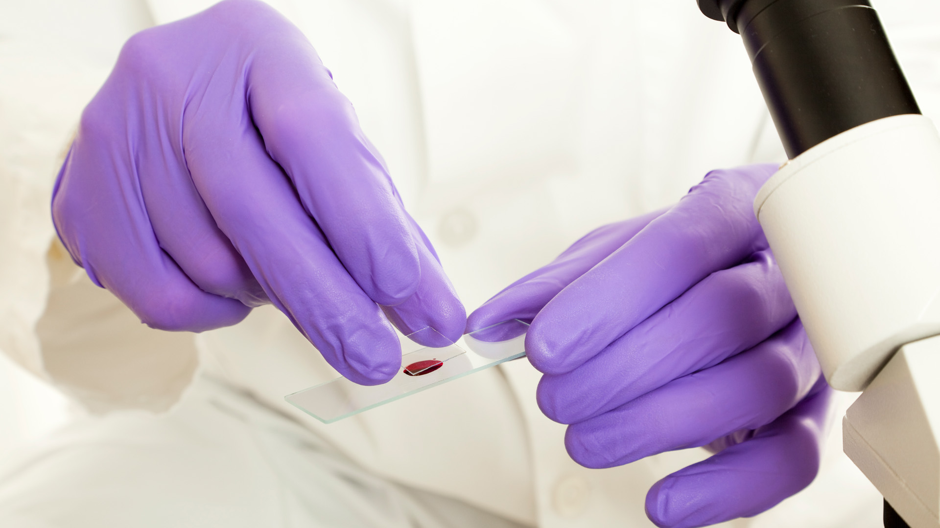 Wat is een EMB test: de waarde van ons bloed